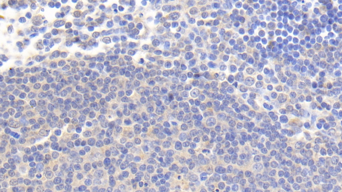 Monoclonal Antibody to Interleukin 4 Induced Protein 1 (IL4I1)