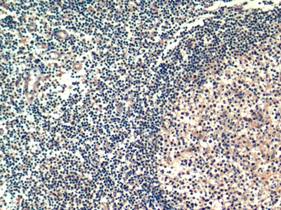 Monoclonal Antibody to Hepatitis A Virus Cellular Receptor 2 (HAVCR2)