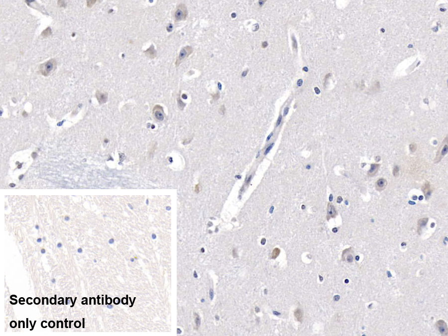 Monoclonal Antibody to Lecithin Cholesterol Acyltransferase (LCAT)
