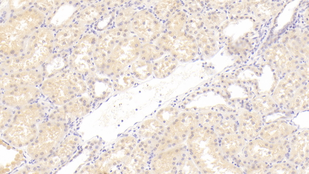 Monoclonal Antibody to C1q And Tumor Necrosis Factor Related Protein 1 (C1QTNF1)