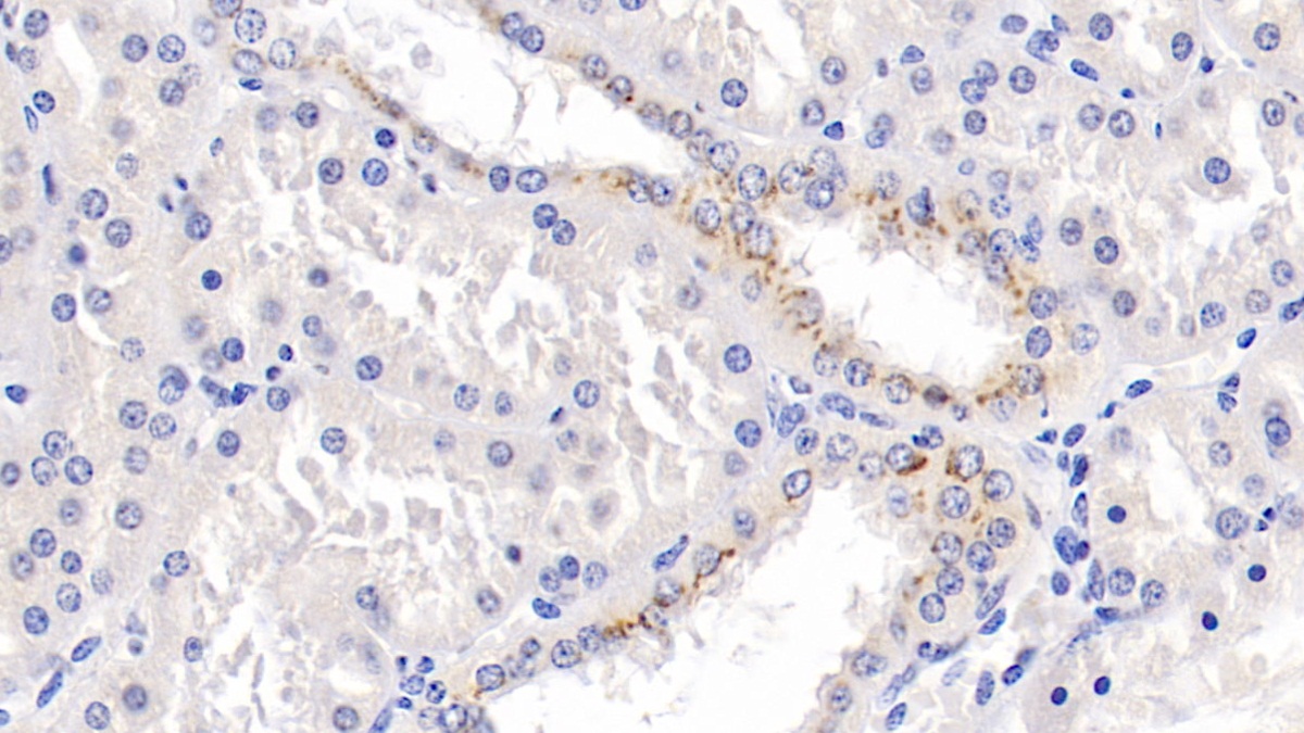 Monoclonal Antibody to Parkinson Disease Protein 7 (PARK7)