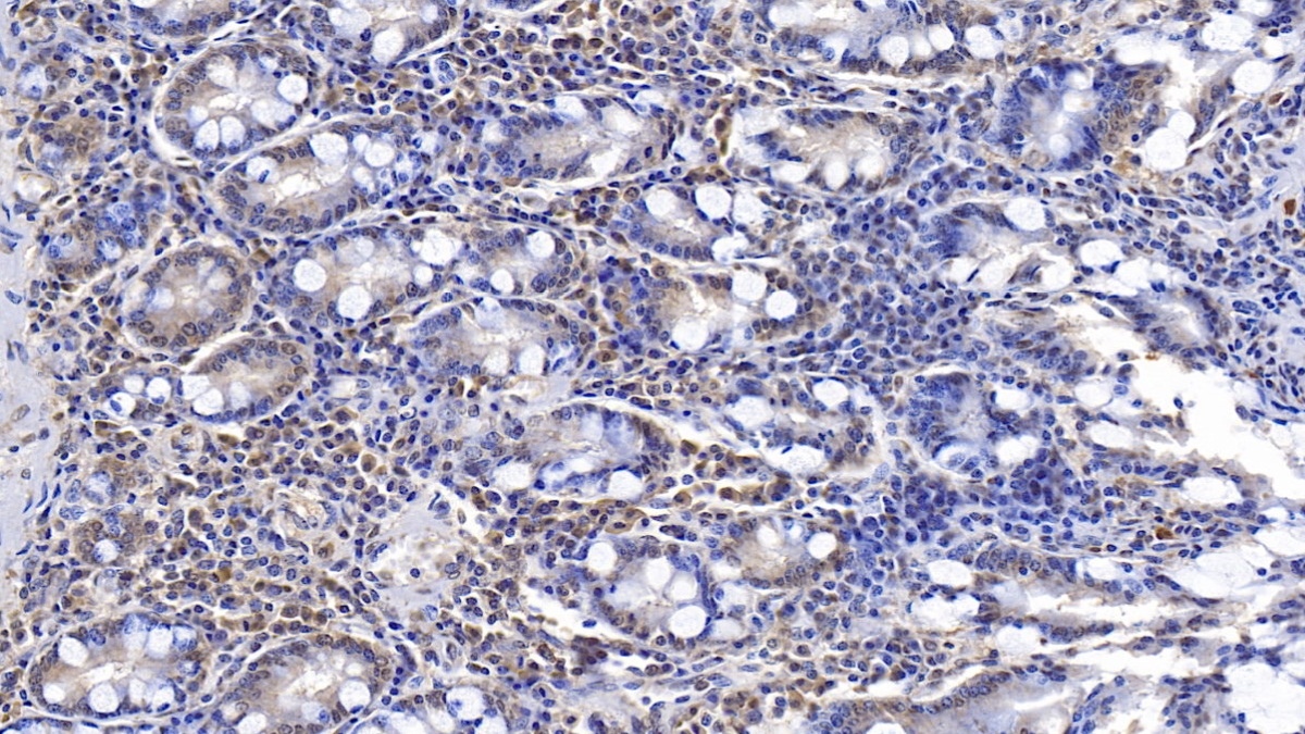 Monoclonal Antibody to Endoplasmic Reticulum Lipid Raft Associated Protein 2 (ERLIN2)