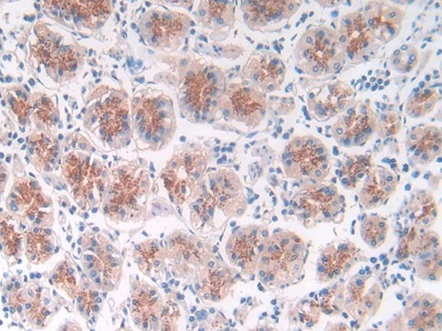 Monoclonal Antibody to Suppression Of Tumorigenicity 14 (ST14)