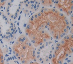 Polyclonal Antibody to Eosinophil Chemotactic Factor (ECF)