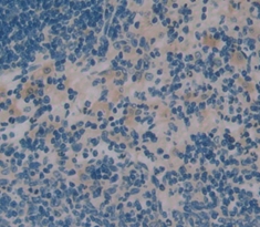 Polyclonal Antibody to Interleukin 16 (IL16)