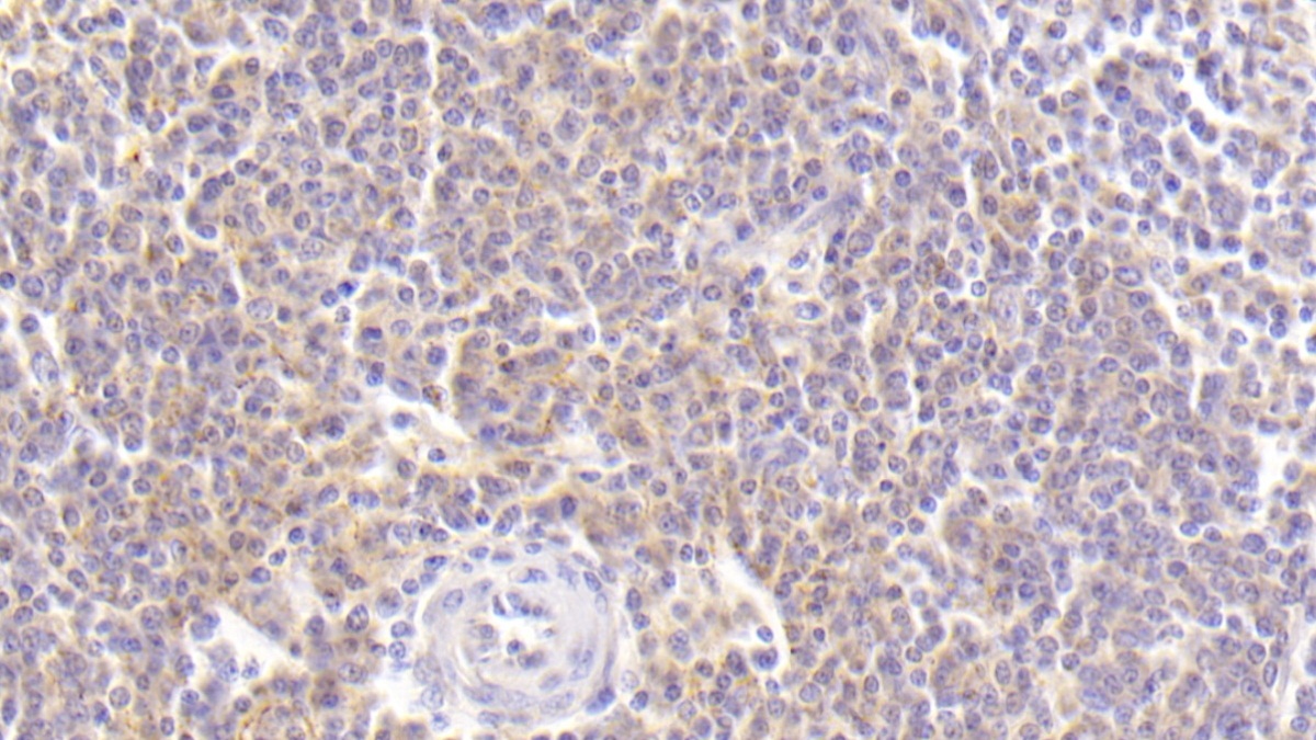 Polyclonal Antibody to Macrophage Derived Chemokine (MDC)