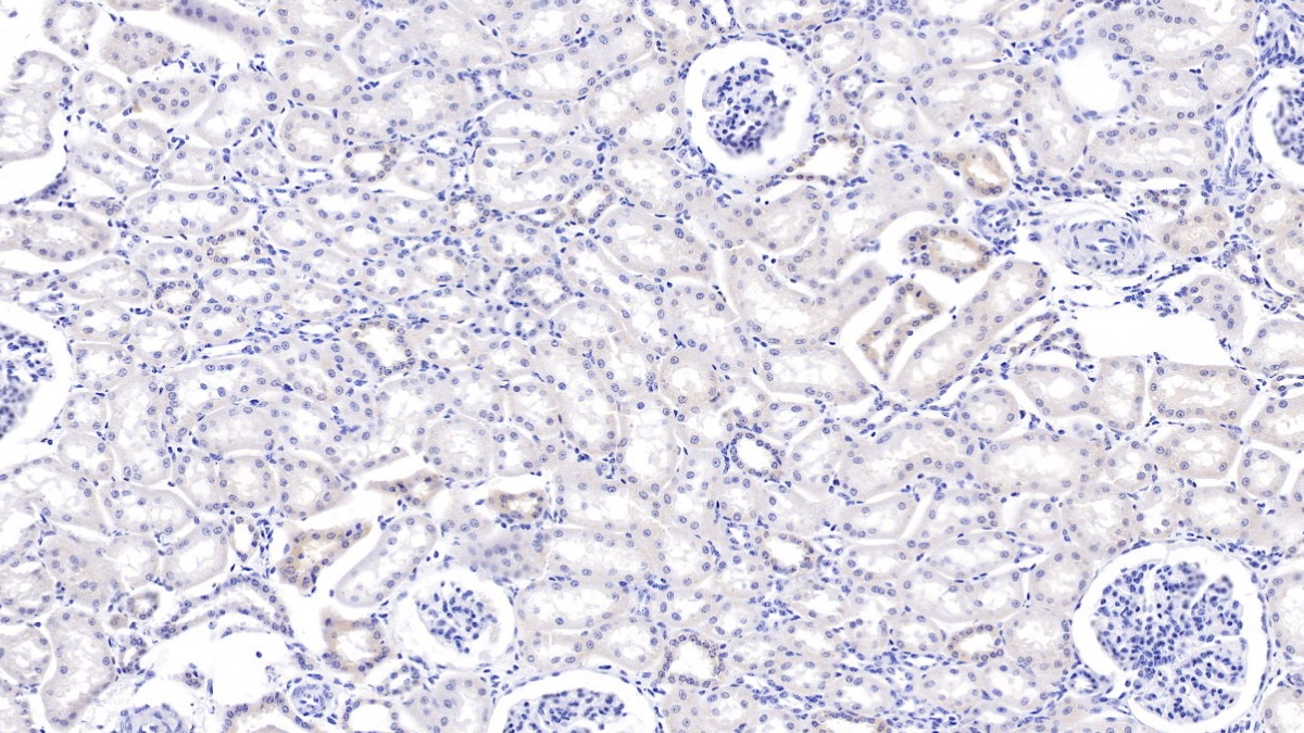 Polyclonal Antibody to Matrix Metalloproteinase 7 (MMP7)