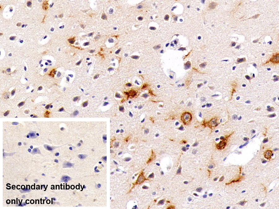 Polyclonal Antibody to Nerve Growth Factor (NGF)