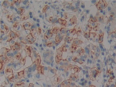Polyclonal Antibody to Neurotrophin 4 (NT4)