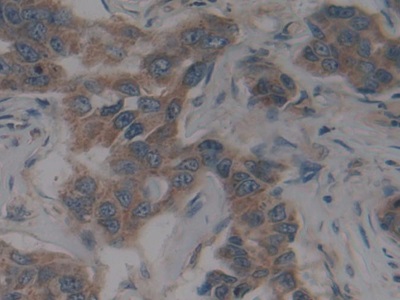 Polyclonal Antibody to Stem Cell Factor Receptor (SCFR)