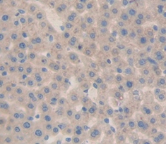 Polyclonal Antibody to Tumor Necrosis Factor Beta (TNFb)