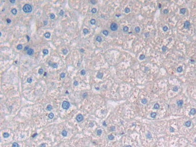 Polyclonal Antibody to Prostatic Acid Phosphatase (PAP)