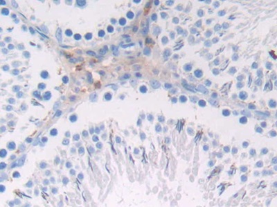 Polyclonal Antibody to Galactosidase Beta (GLb)