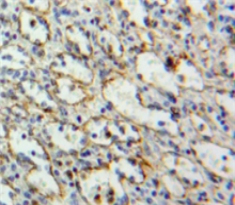 Polyclonal Antibody to Linker For Activation Of T-Cell (LAT)