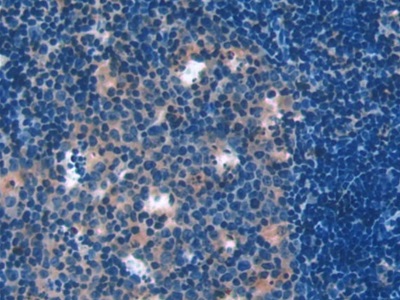 Polyclonal Antibody to Talin 1 (TLN1)