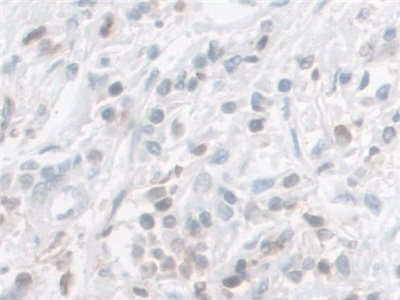 Polyclonal Antibody to Galectin 9 (GAL9)