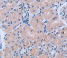 Polyclonal Antibody to Xeroderma Pigmentosum, Complementation Group C (XPC)