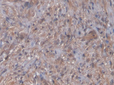 Polyclonal Antibody to N-Terminal Pro-Brain Natriuretic Peptide (NT-ProBNP)