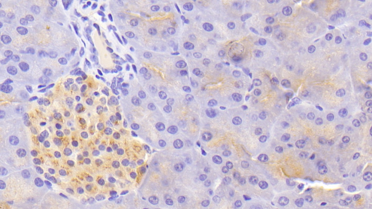 Polyclonal Antibody to Tissue Factor (TF)