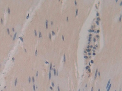 Polyclonal Antibody to Enolase, Neuron Specific (NSE)