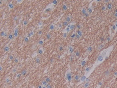 Polyclonal Antibody to Granzyme B (GZMB)