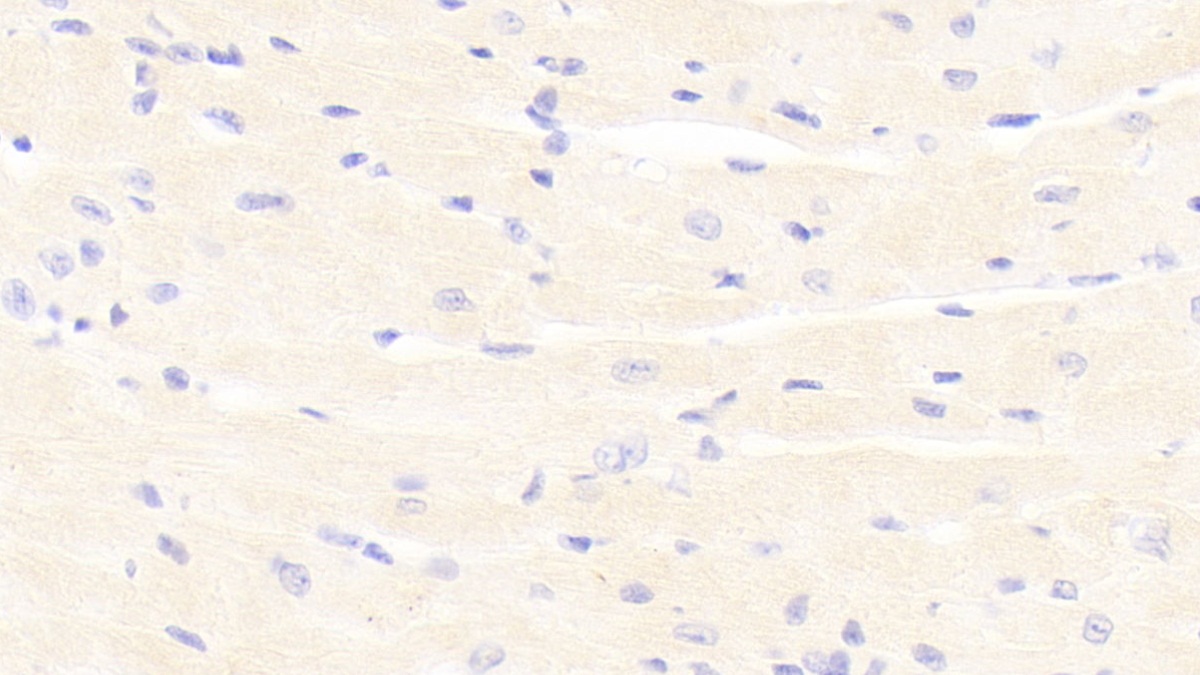 Polyclonal Antibody to Platelet Derived Growth Factor BB (PDGF BB)