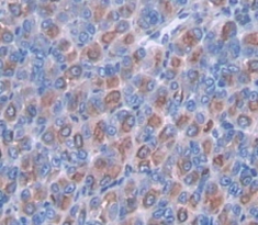 Polyclonal Antibody to Mucin 5 Subtype AC (MUC5AC)
