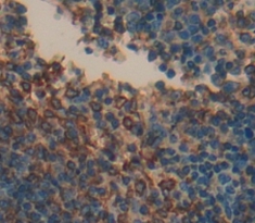 Polyclonal Antibody to Tumor Necrosis Factor Receptor Superfamily, Member 17 (TNFRSF17)