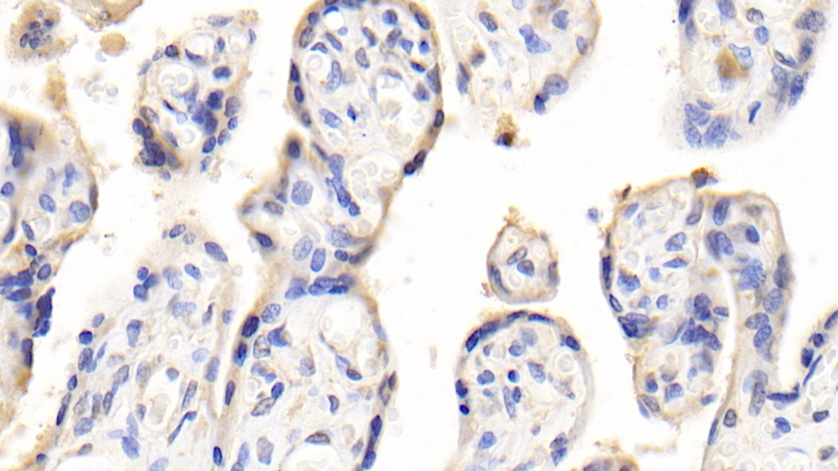 Polyclonal Antibody to Pregnancy Associated Plasma Protein A (PAPPA)