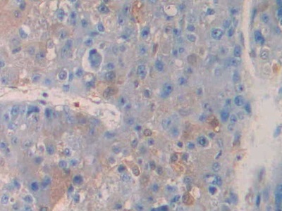 Polyclonal Antibody to Tumor Necrosis Factor Receptor Superfamily, Member 12A (TNFRSF12A)