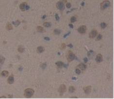 Polyclonal Antibody to Corticotropin Releasing Factor (CRF)