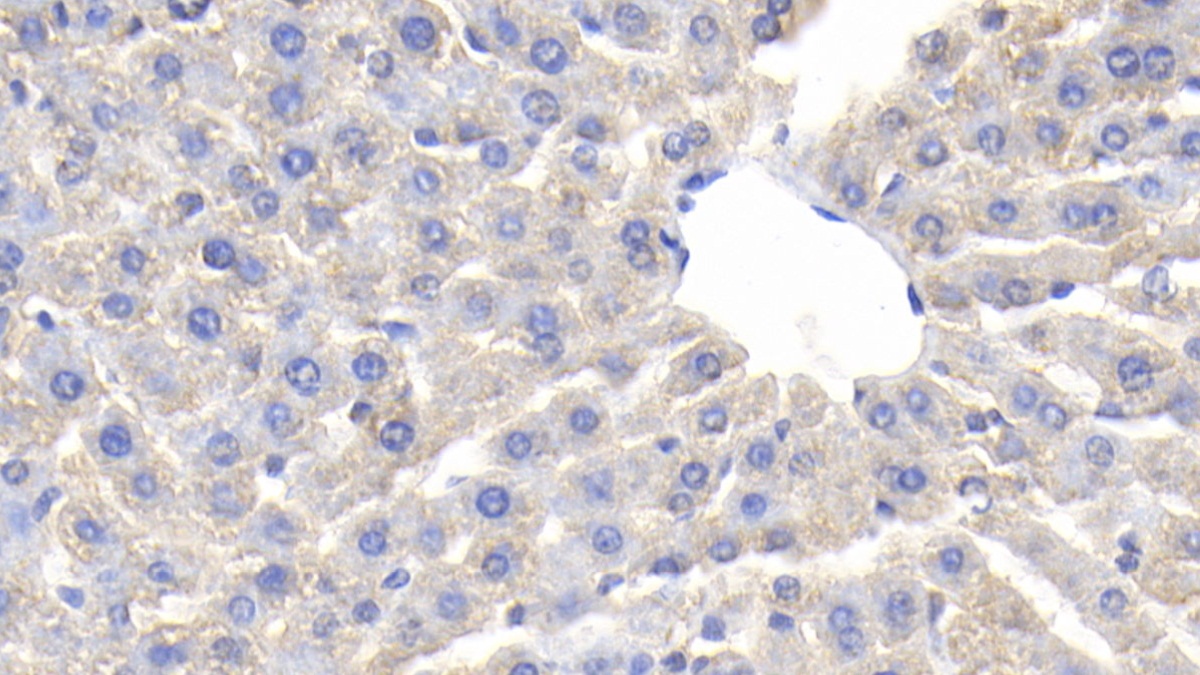Polyclonal Antibody to Ceruloplasmin (CP)