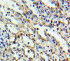 Polyclonal Antibody to Cluster Of Differentiation 6 (CD6)