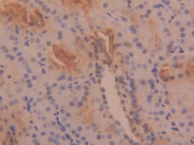 Polyclonal Antibody to Tryptase (TPS)