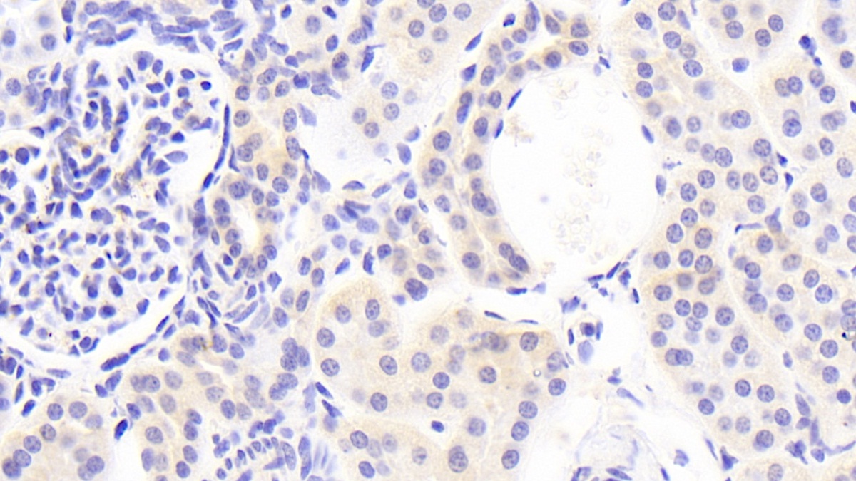 Polyclonal Antibody to Cadherin, Osteoblast (CDHOB)