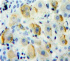 Polyclonal Antibody to Cluster Of Differentiation 1d (CD1d)
