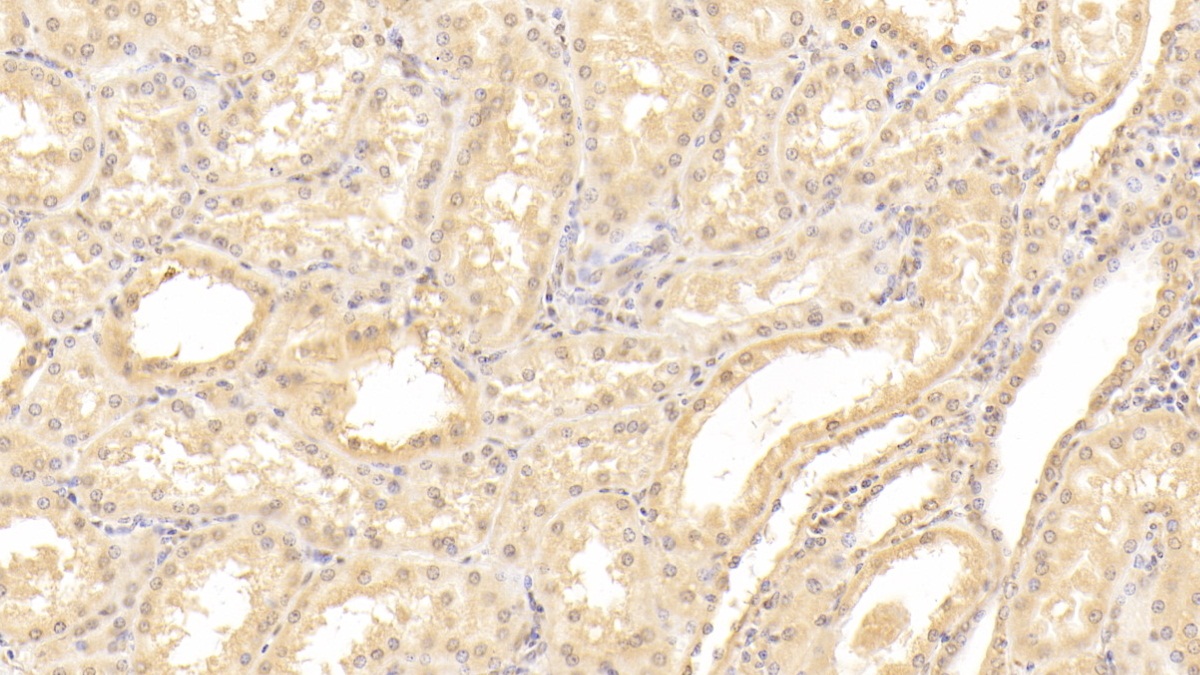 Polyclonal Antibody to Taxilin Alpha (TXLNa)