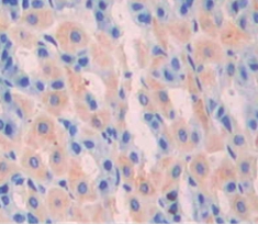 Polyclonal Antibody to Gastrin (GT)