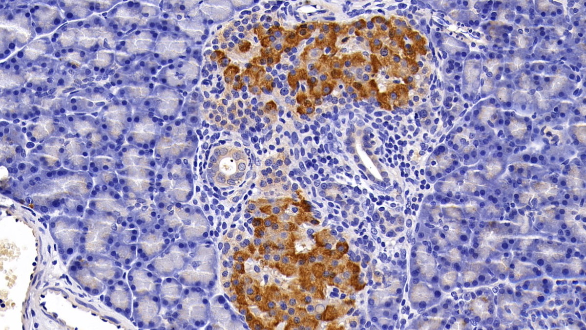 Polyclonal Antibody to Gastrin (GT)