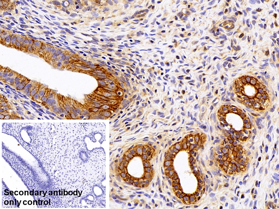 Polyclonal Antibody to Cytokeratin 19 (CK19)