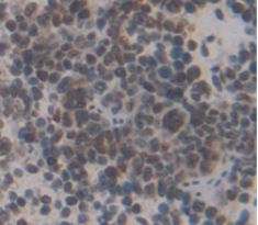 Polyclonal Antibody to V-Myc Myelocytomatosis Viral Oncogene Homolog (MYC)