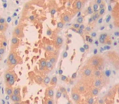 Polyclonal Antibody to V-Ha-Ras Harvey Rat Sarcoma Viral Oncogene Homolog (HRAS)