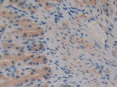 Polyclonal Antibody to Complement Component 8b (C8b)
