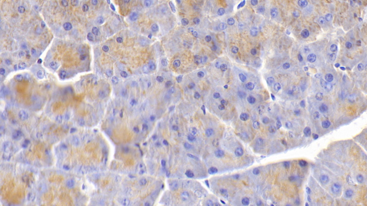 Polyclonal Antibody to Elastin (ELN)
