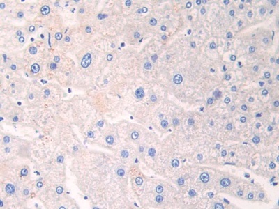 Polyclonal Antibody to Adipose Differentiation Related Protein (ADRP)