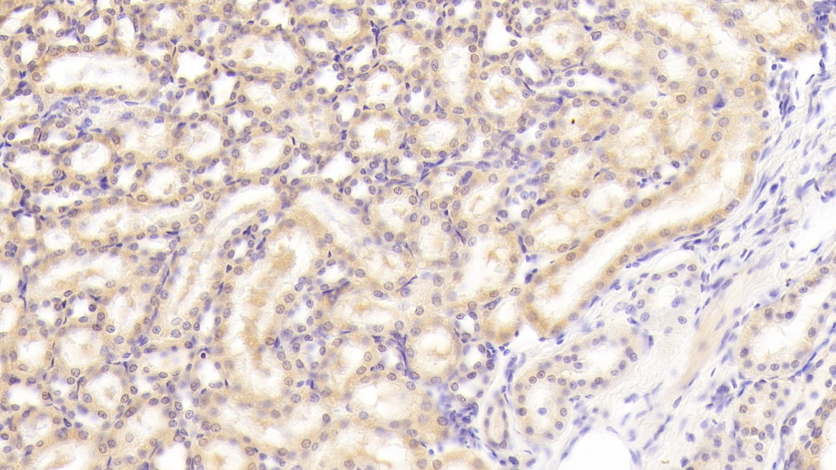 Polyclonal Antibody to Macrophage Expressed Gene 1 Protein (MPG1)