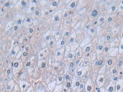 Polyclonal Antibody to Cluster Of Differentiation 74 (CD74)