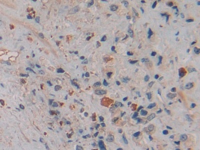 Polyclonal Antibody to Neutrophil gelatinase-associated lipocalin (NGAL)