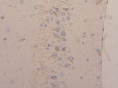 Polyclonal Antibody to Neutrophil gelatinase-associated lipocalin (NGAL)
