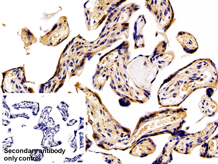 Polyclonal Antibody to Placental Protein 13 (PP13)